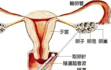 2026年没有精子去山东中医药附属医院做精子试管可以吗？分为哪几大步骤